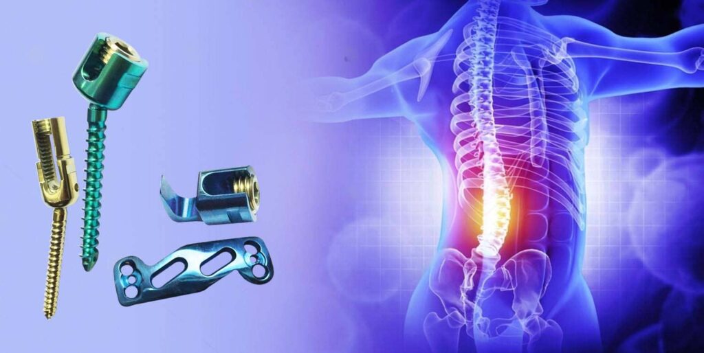 Spine Implants – It's Types and Purpose in Health Care - HEMC Ortho