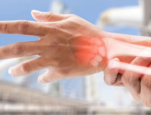 What are the Signs and Symptoms of Wrist Fractures?