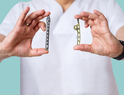 Orthopedic Implants India: Their Types and Importance